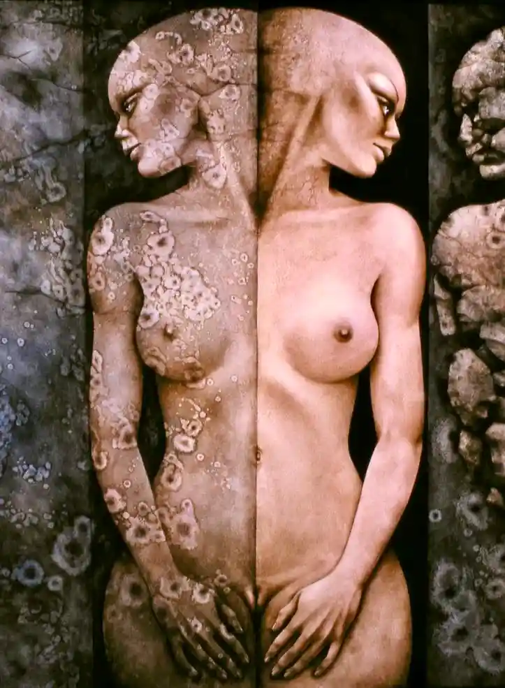 Image galerie